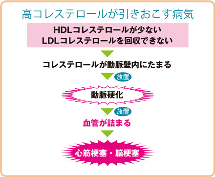 コレステロール高めは動脈硬化を招く